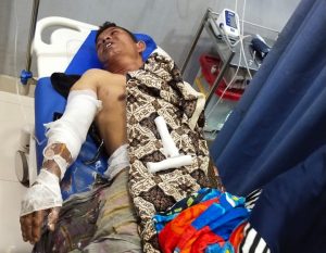 Musibah Kebakaran di Aceh Utara, Sepasang Suami Istri Alami Luka Bakar
