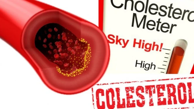 Waspada, Masuk Usia 40 Kolesterol Makin Meningkat